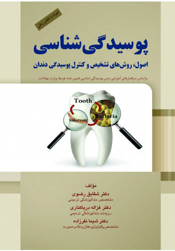 کتاب پوسیدگی شناسی - اصول، روش های تشخیص و کنترل پوسیدگی دندان دکتر رضوی