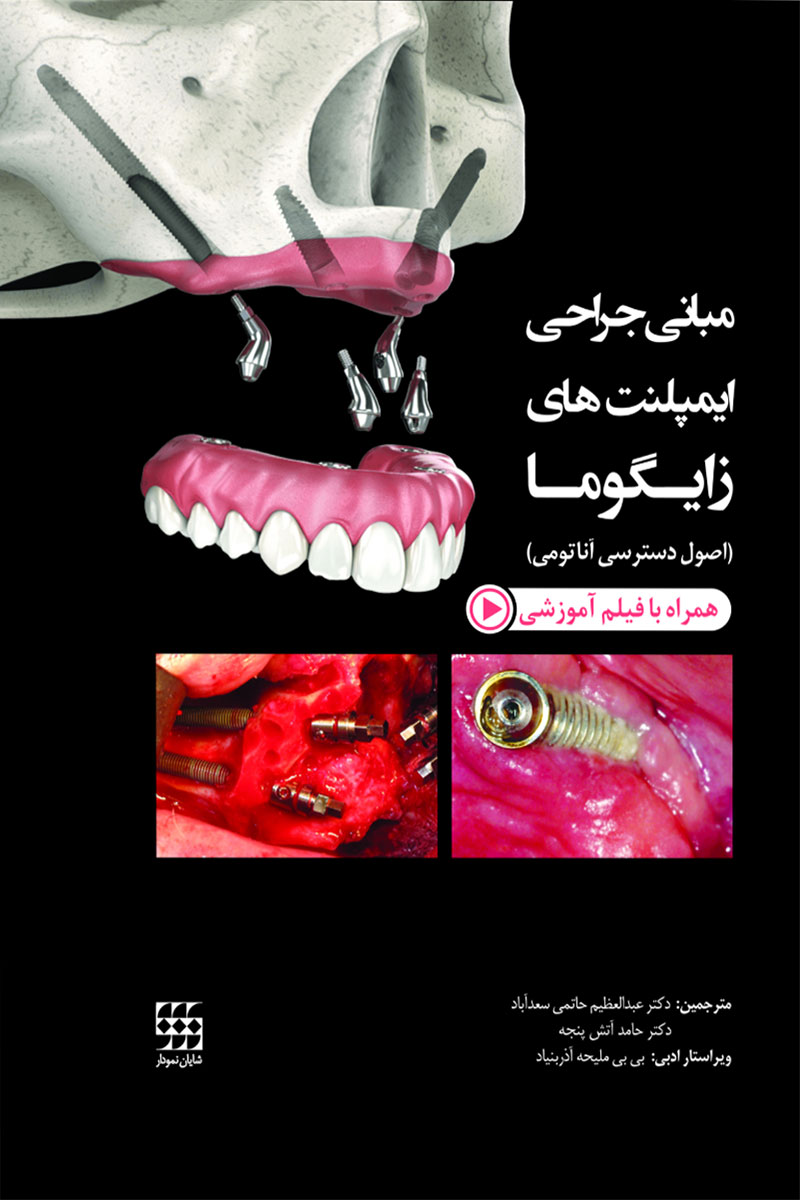 کتاب مبانی جراحی ایمپلنت های زایگوما(اصول دسترسی آناتومی)-همراه با فیلم آموزشی-مترجم دکتر عبدالعظیم حاتمی سعدآباد
