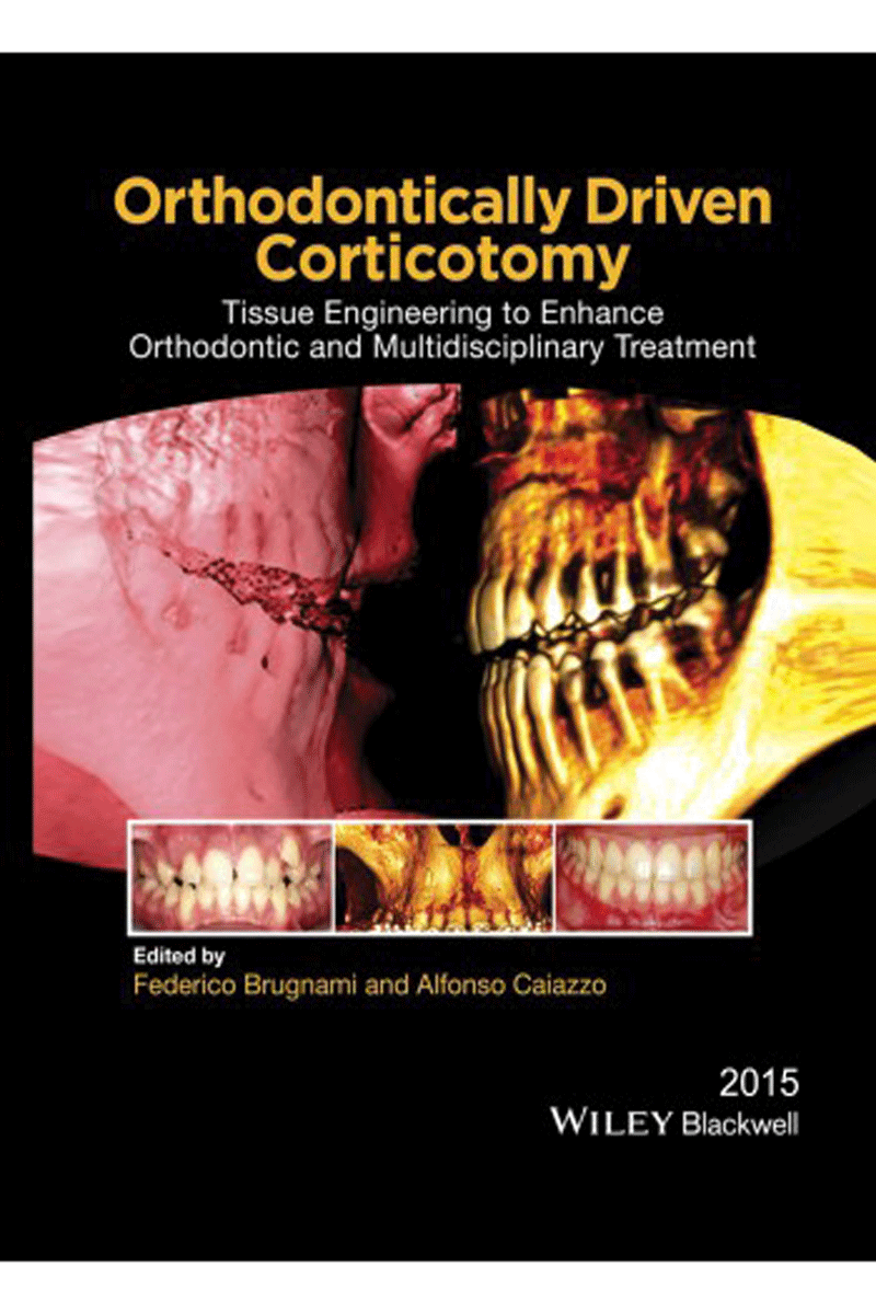 کتاب Orthodontically Driven Corticotomy 2015- نویسنده Federico Brugnami