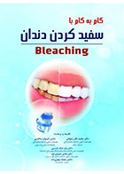 کتاب گام به گام با سفید کردن دندان (Bleaching)-نویسنده دکتر محمدباقر رضوانی و دیگران