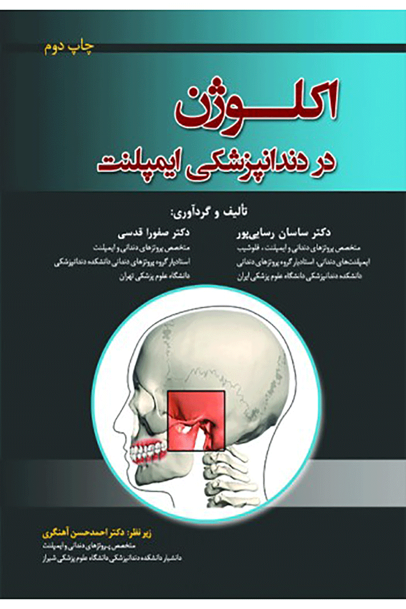 کتاب اکلوژن در دندانپزشکی ایمپلنت-نویسنده دکتر صفورا قدسی
