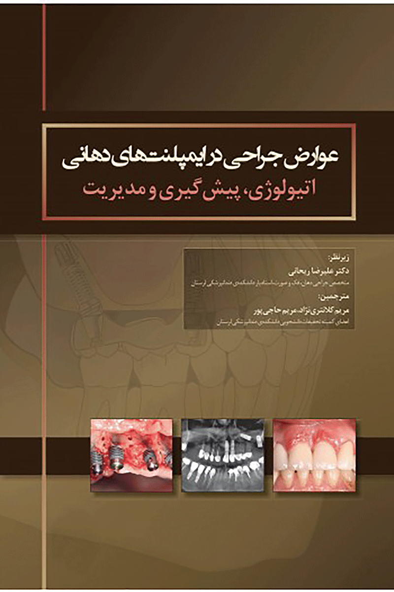 کتاب عوارض جراحی در ایمپلنت های دهانی اتیولوژی، پیشگیری و مدیریت -نویسنده دکتر علیرضا ریحانی