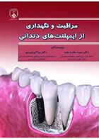 کتاب مراقبت و نگهداری از ایمپلنت‌های دندانی-نویسنده دکتر مژگان ایزدی