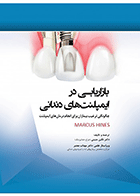 کتاب بازاریابی در ایمپلنت های دندانی چگونگی ترغیب بیماران برای انجام درمان های ایمپلنت-نویسنده دکتر نگین متینی 