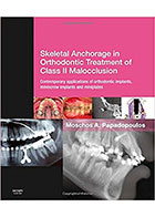 کتابSkeletal Anchorage in Orthodontic Treatment of Class II Malocclusion 2015- نویسندهMOSCHOS A. PAPADOPOULOS