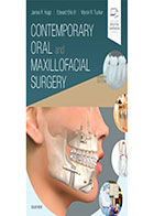کتاب Contemporary Oral and Maxillofacial Surgery- نویسندهJames Hupp