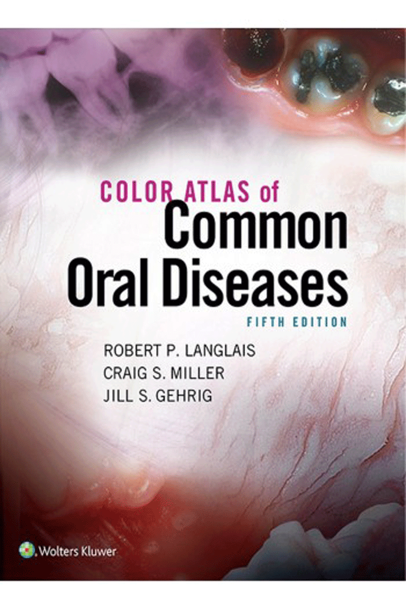 کتاب Color Atlas Of Common Oral Diseases 2017-نویسنده RObeRT P. LAnGLAIS