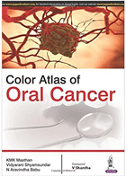 کتاب Color Atlas of Oral Cancer-نویسنده KMK Masthan
