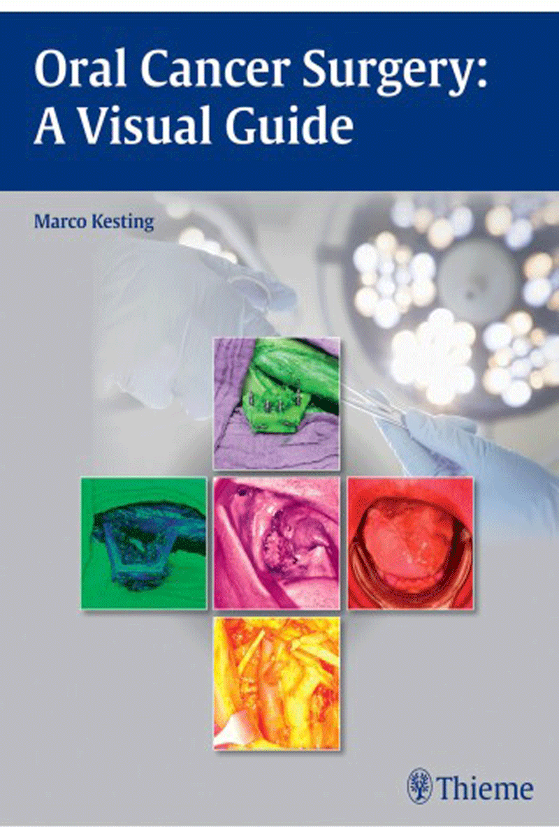 کتاب Oral Cancer Surgery: A Visual Guide-نویسنده Marco Kesting