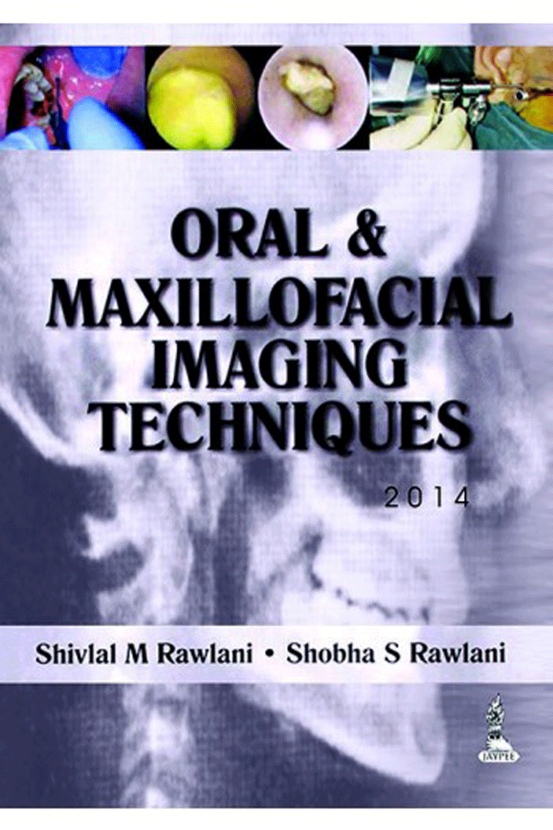 کتاب Oral & Maxillofacial Imaging Techniques-نویسنده Shivlal M Rawlani