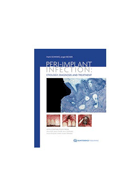 کتاب Peri-Implant Infection 2009-نویسنده Frank Schwarz  
