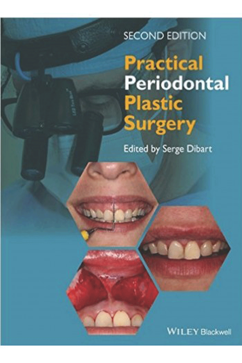 کتاب PRACTICAL PERIODONTAL PLASTIC SURGERY-نویسنده  Serge Dibart