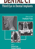 کتاب DENTAL CT Third Eye in Dental Implants-نویسنده Prashant P Jaju
