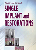 کتاب Principle and Practice of Single Implant and Restoration-نویسنده Mahmoud Torabinejad 