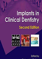 کتاب Implant in Clinical Dentistry-نویسنده Richard M. Palmer 