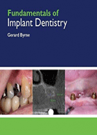 کتاب Fundamentals of Implant Dentistry-نویسنده Gerard Byrne 