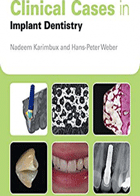 کتاب Clinical Cases in Implant Dentistry-نویسنده Nadeem Karimbux 