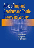کتاب Atlas of Implant Dentistry and Tooth-Preserving Surgery Prevention and Management of Complications-نویسنده Zoran Stajčić 