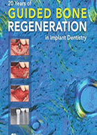 کتاب ۲۰Years of Guided Bone Regeneration in Implant Dentistry-نویسنده Daniel Buser 