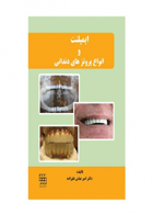 کتاب ایمپلنت و انواع پروتزهای دندانی-نویسنده دکتر امیرعباس علیزاده