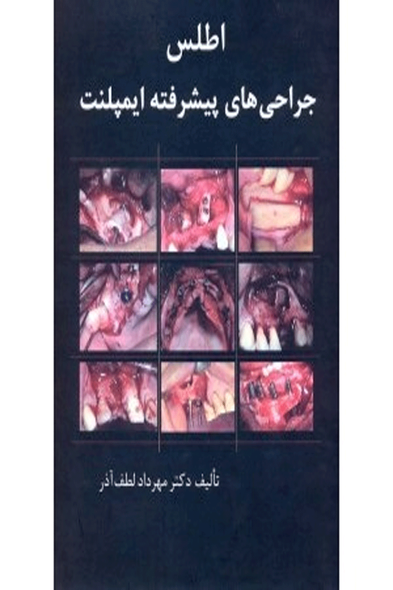 کتاب اطلس جراحی های پیشرفته ایمپلنت-نویسنده دکتر مهرداد لطف آذر