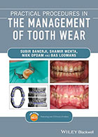 کتاب Practical Procedures in the Management of Tooth Wear2020- نویسنده سوبیر بنرجی