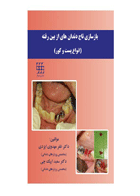 کتاب بازسازی تاج دندان های از بین رفته (انواع پست و کور) – رنگی- نویسنده دکتر ظفر مهدوی ایزدی 