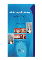 کتاب ترمیم دندان های درمان ریشه شده (مبانی تکنیک های بالینی) - نویسنده دکتر محمود بهاری