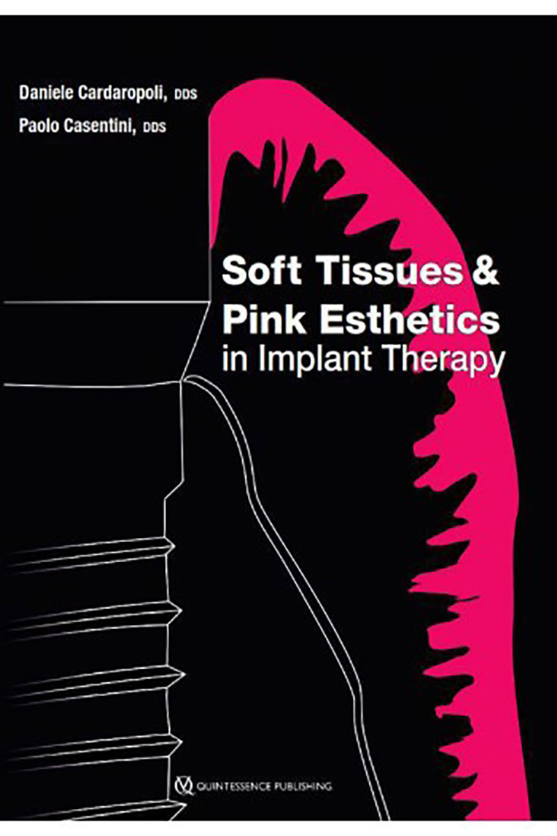 کتابSoft Tissues and Pink Esthetics in Implant Therapy2020- نویسندهDaniele Cardaropoli