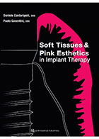 کتابSoft Tissues and Pink Esthetics in Implant Therapy2020- نویسندهDaniele Cardaropoli