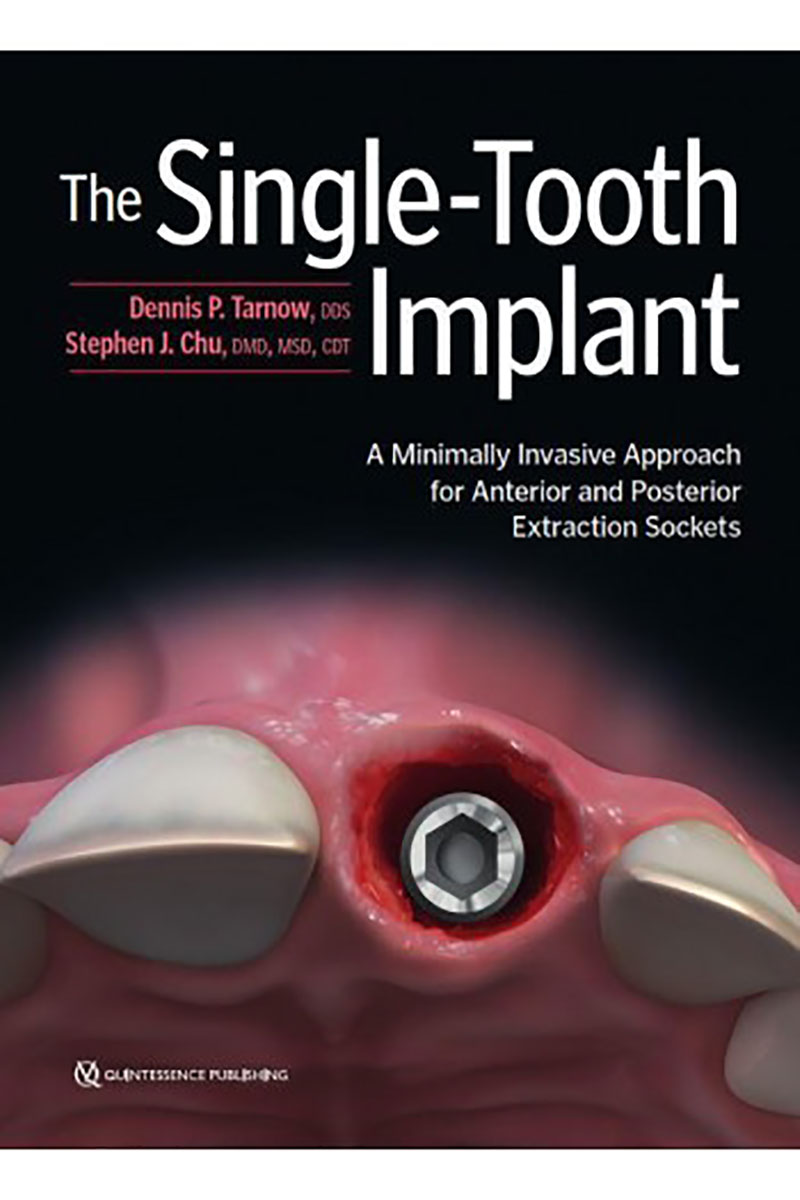 کتابThe Single-Tooth Implant 2020- نویسندهDennis P. Tarnow