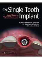 کتابThe Single-Tooth Implant 2020- نویسندهDennis P. Tarnow