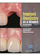 کتابImplant Dentistry at a Glance 2018- نویسندهJacques Malet