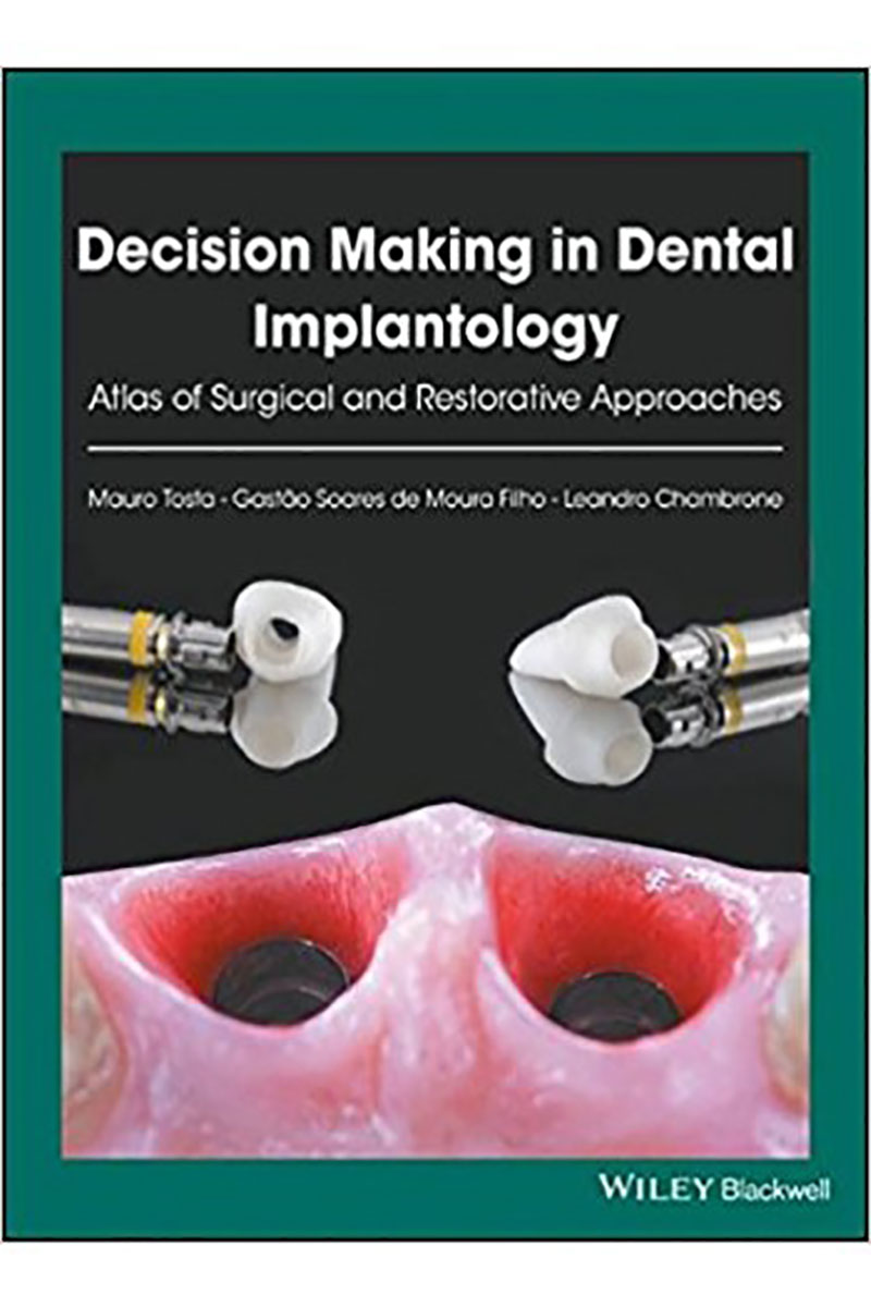 کتابDecision Making in Dental Implantology 2018- نویسندهMauro Tosta