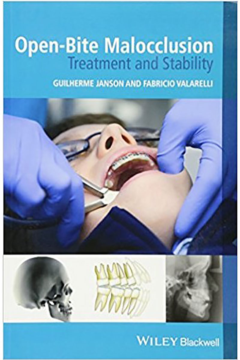 کتابOpen-Bite Malocclusion Treatment and Stability 2014- نویسندهGuilherme Janson