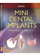 کتابMini Dental Implants 2013- نویسندهVictor I. Sendax