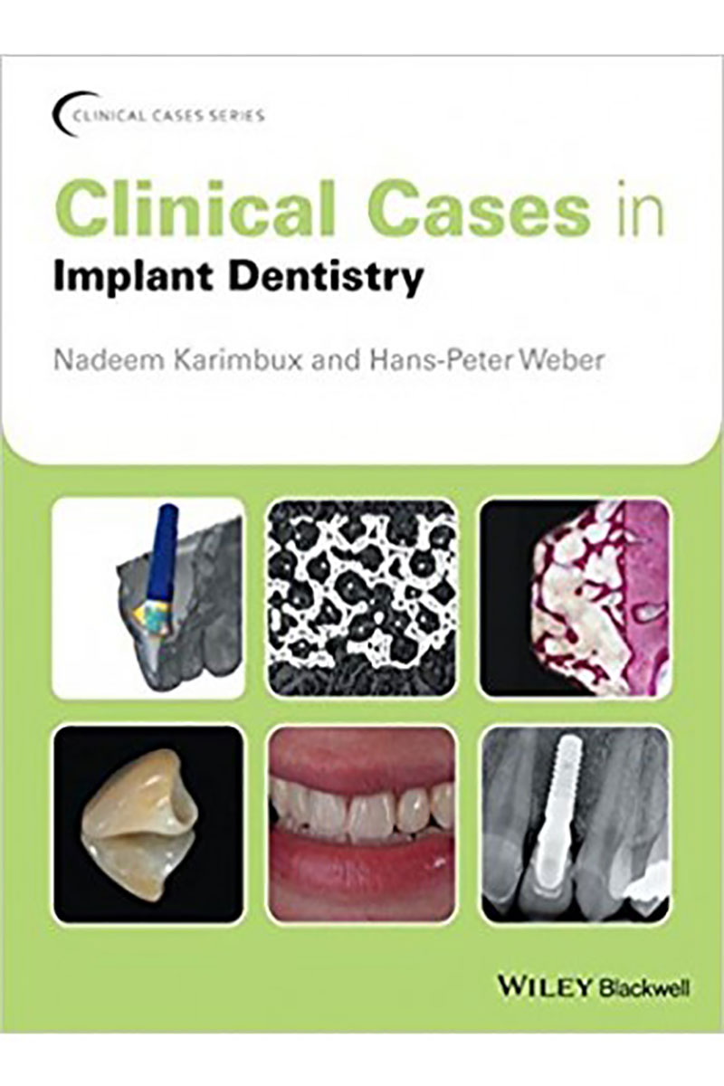 کتابClinical Cases in Implant Dentistry2017- نویسندهNadeem Karimbux