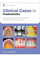 کتابClinical Cases in Prosthodontics2011- نویسندهLeila Jahangiri