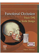  Functional Occlusion: From TMJ to Smile Design- نویسنده Peter E. Dawson