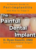 The Painful Dental Implant- نویسنده  H. Ryan Kazemi