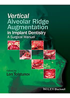 Vertical Alveolar Ridge Augmentation in Implant Dentistry- نویسندهLen Tolstunov