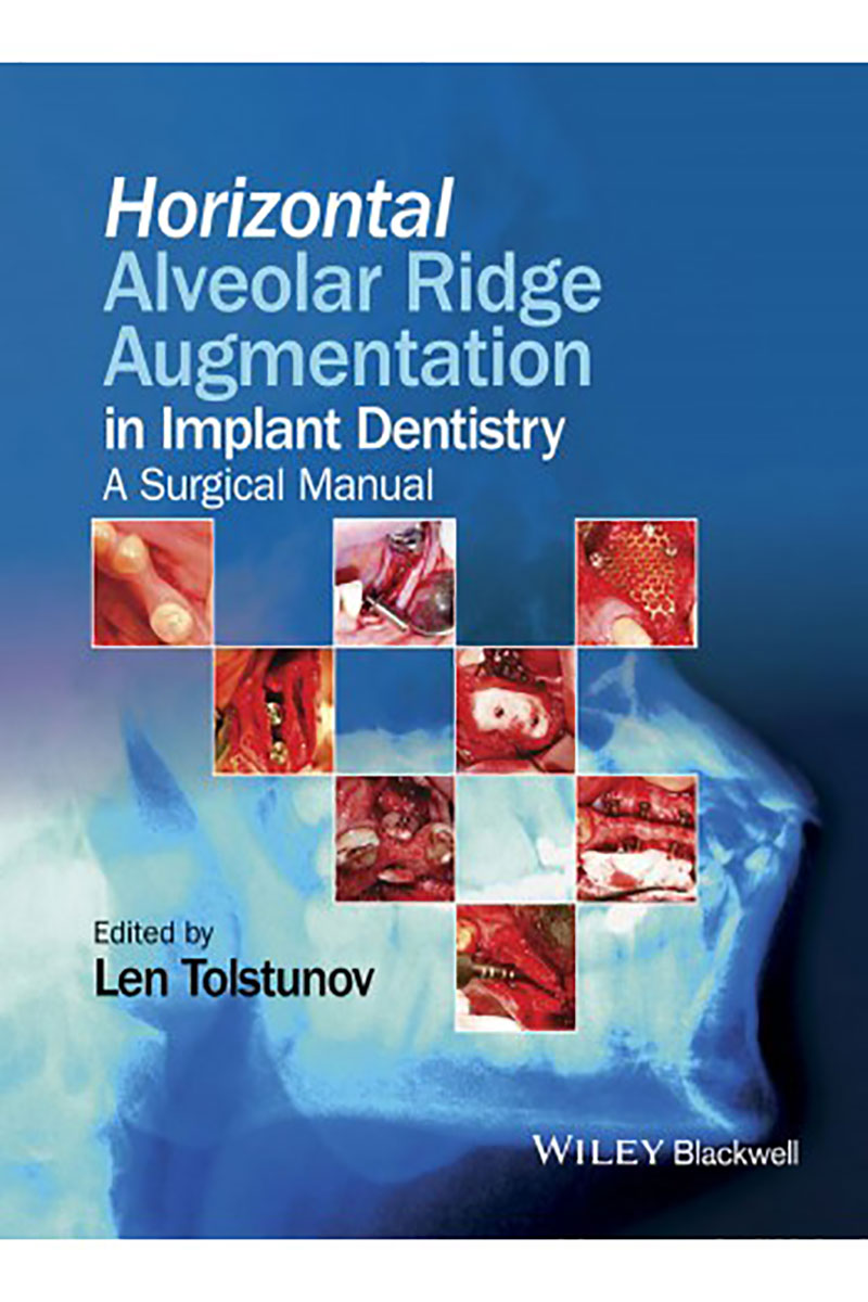  Horizontal Alveolar Ridge Augmentation in Implant Dentistry- نویسندهLen Tolstunov