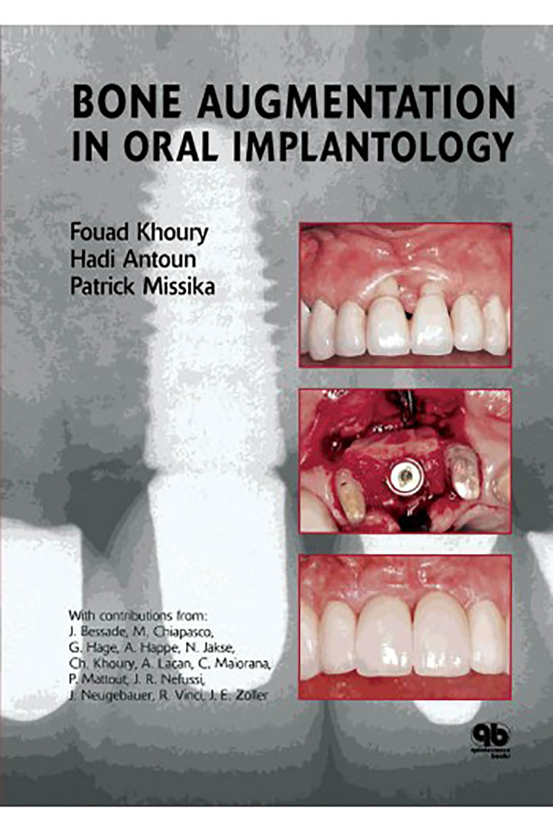 Bone Augmentation In Oral Implantology- نویسنده Fouad Khoury