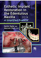  Esthetic Implant Restoration in the Edentulous Maxilla 2014- نویسندهKarim Dada