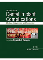  Dental Implant Complications 2016-نویسندهStuart J. Froum