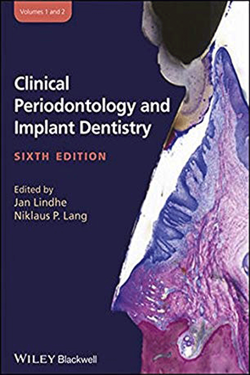 کتاب(Clinical Periodontology and Implant Dentistry Lindhe (2 Vol- نویسندهNiklaus P. Lang