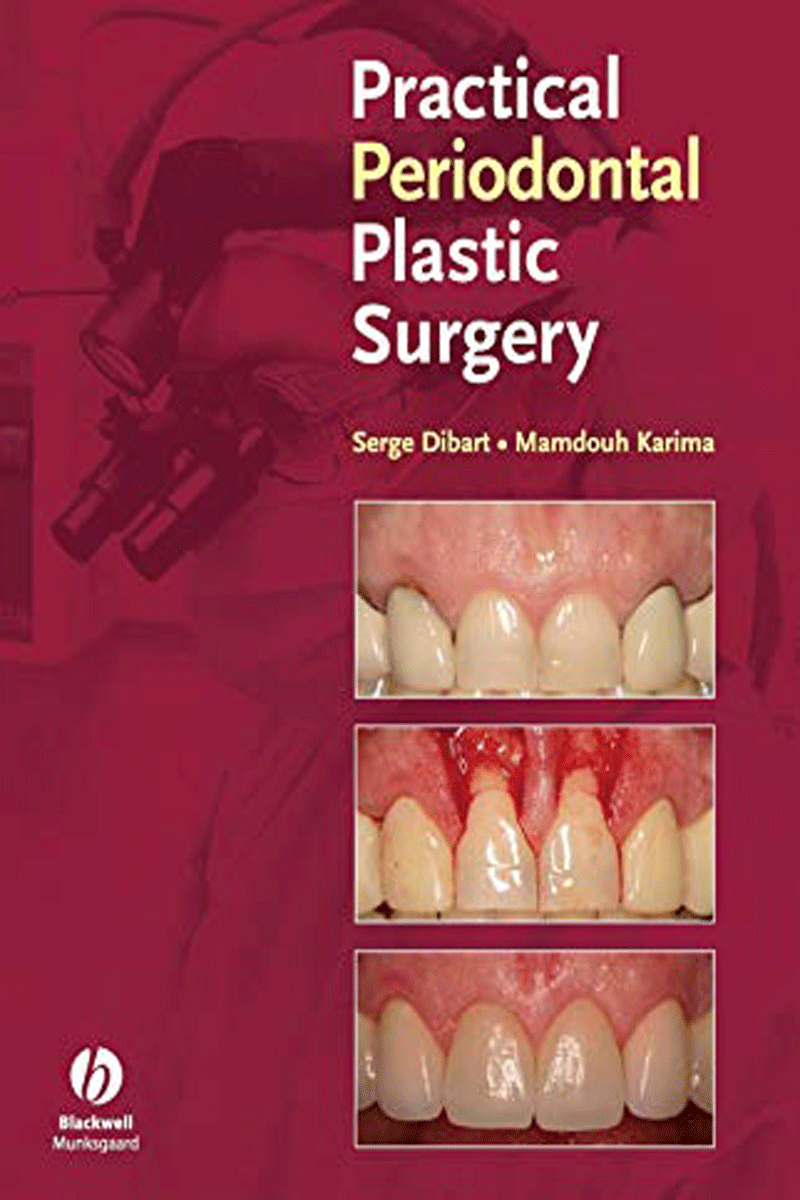 کتابPractical Periodontal Plastic Surgery- نویسندهSerge Dibart
