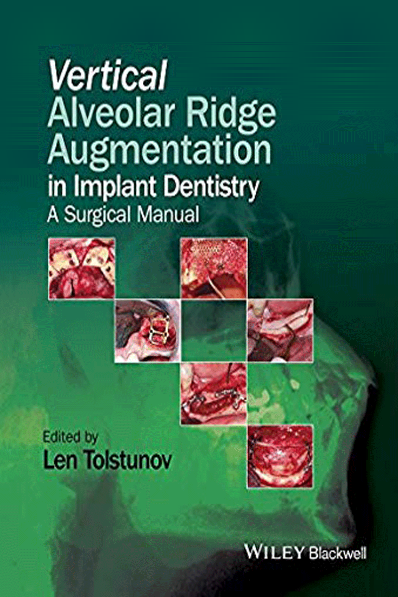 کتابVertical Alveolar Ridge Augmentation Implant Dentistry a surgical manual- نویسندهLen Tolstunov