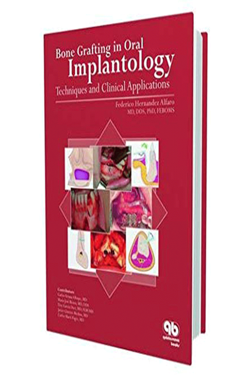 کتابBone Grafting in Oral Implantology- نویسندهFederico H Alfaro Ed