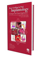 کتابBone Grafting in Oral Implantology- نویسندهFederico H Alfaro Ed